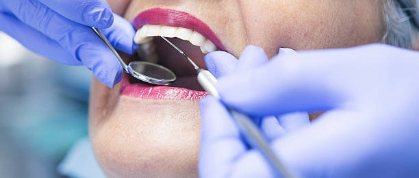 Best Broken or Cracked Tooth Emergency Dentist in Bryant, WA